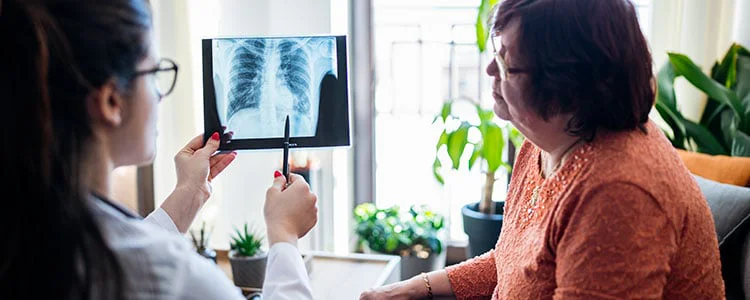 Médico que explica cómo un paciente tiene mesotelioma mediante una radiografía